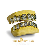 Custom 6pcs Two Tones Diamond Cuts Grillz: 925 Sterling Silver (Free Mold Kit)