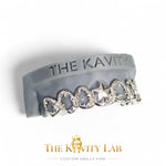Custom 8pcs Intricate Baroque Royal Design Grillz: 925 Sterling Silver (Free Mold Kit)