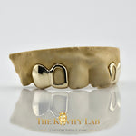 Custom 4pcs Solid Class x Open Face Grillz: 925 Sterling Silver (Free Mold )