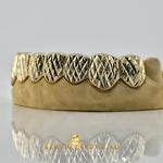 Custom Diamond Cut x Dust Grillz: 925 Sterling Silver (Free Mold Kit)