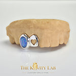 Custom 2pcs Open Heart x Blue Opal Stone Grillz: 925 Sterling Silver (Free Mold Kit)