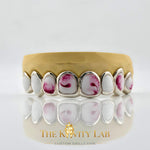 Custom 8pcs Red and White Marble Enamel Grillz: 925 Sterling Silver (Free Mold Kit)