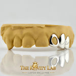 Custom 3pc Open Face x Solid Caps Grillz: 925 Sterling Silver (Free Mold Kit)