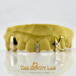 Custom 6pcs 3D Star x Gap Filler Grillz: 925 Sterling Silver (Free Mold Kit)