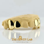 Custom 4pcs Solid Class: 925 Sterling Silver (Free Mold Kit)