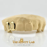 Custom 2pcs Open Face Grillz: 925 Sterling Silver (Free Mold Kit)