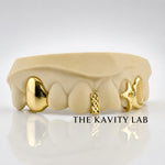 Custom 6pcs 3D Star x Gap Filler Grillz: 925 Sterling Silver (Free Mold Kit)