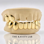 Custom 3o8 Moissanite Tip with Perm Cuts Grillz Set: 925 Sterling Silver (Free Mold Kit)