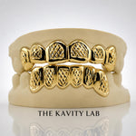 Custom 6pcs Diamond Cuts and Dust Box Grillz: 925 Sterling Silver (Free Mold Kit)