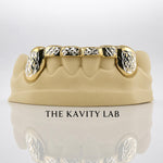 Custom 6pcs White Cut x Front Bar Grillz: 925 Sterling Silver (Free Mold Kit)