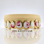 Custom 8pcs Red and White Marble Enamel Grillz: 925 Sterling Silver (Free Mold Kit)