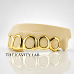 Custom 6pcs Open Face Style Grillz: 925 Sterling Silver (Free Mold Kit)