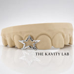 Custom 3pcs with Star Cuts Grillz: 925 Sterling Silver (Free Mold Kit)