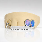 Custom 6pc Blue Opals with Big 3D Stars GRILLZ: 925 Sterling Silver (Free Mold Kit)