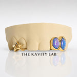 Custom 6pc Blue Opals with Big 3D Stars GRILLZ: 925 Sterling Silver (Free Mold Kit)