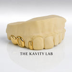Custom 3pc Open Face x Diamond Cuts Gap Filler GRILLZ: 925 Sterling Silver (Free Mold Kit)