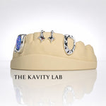 Custom 8pcs Blue Opal with Stars Grillz: 925 Sterling Silver (Free Mold Kit)