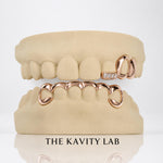 Custom 3on6 Moissanite Tip and Bar Grillz: 925 Sterling Silver (Free Mold Kit)