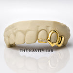 Custom 3pcs Open Face and Moissanite Tip Grillz: 925 Sterling Silver (Free Mold Kit)
