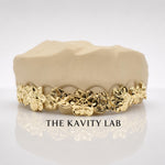 Custom 8pcs 3D Floral Engraved Grillz: 925 Sterling Silver (Free Mold Kit)