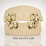 Custom 4pc Open Hearts GRILLZ: 925 Sterling Silver (Free Mold Kit)