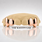 Custom 4pcs Solid Class: 925 Sterling Silver (Free Mold Kit)