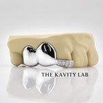 Custom 3pcs Plain Jane x Moissanite Tip Grillz: 925 Sterling Silver (Free Mold Kit)