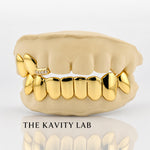 Custom 3o8 Moissanite Tip with Perm Cuts Grillz Set: 925 Sterling Silver (Free Mold Kit)