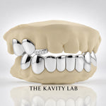 Custom 3o8 Moissanite Tip with Perm Cuts Grillz Set: 925 Sterling Silver (Free Mold Kit)