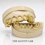 Custom 8pcs Diamond Cut x Open Face Grillz: 925 Sterling Silver (Free Mold Kit)
