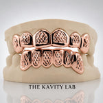 Custom 6pcs Diamond Cuts and Dust Box Grillz: 925 Sterling Silver (Free Mold Kit)