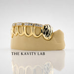 Custom 6pcs Iced Out Front Bar x Diamond Cuts Grillz: 925 Sterling Silver (Free Mold Kit)