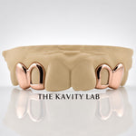 Custom 4pcs Solid Class with Open Face Grillz: 925 Sterling Silver (Free Mold )