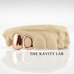 Custom 2pcs Solid x Open Face Grillz: 925 Sterling Silver (Free Mold Kit)