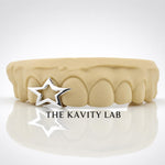 Custom 3pcs with 3D Star Design Grillz: 925 Sterling Silver (Free Mold Kit)