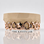 Custom 8pcs Intricate Baroque Royal Design Grillz: 925 Sterling Silver (Free Mold Kit)