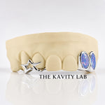 Custom 6pc Blue Opals with Big 3D Stars GRILLZ: 925 Sterling Silver (Free Mold Kit)