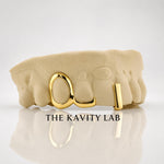 Custom 3pcs Open Face with Gap Filled Grillz: 925 Sterling Silver (Free Mold Kit)