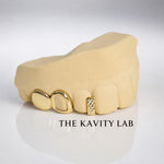 Custom 3pc Open Face x Diamond Cuts Gap Filler GRILLZ: 925 Sterling Silver (Free Mold Kit)