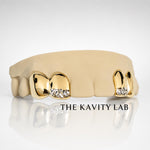 Custom 4pcs White Diamond Cuts Grillz: 925 Sterling Silver (Free Mold Kit)