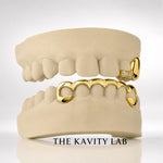 Custom 3on6 Moissanite Tip and Bar Grillz: 925 Sterling Silver (Free Mold Kit)