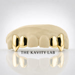 Custom 4pcs Solid with Small Fangs Grillz: 925 Sterling Silver (Free Mold Kit)