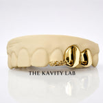 Custom 3pc Rose Detail x Solid Caps Grillz: 925 Sterling Silver (Free Mold Kit)