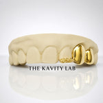Custom 3pc Rose Detail x Solid Caps Grillz: 925 Sterling Silver (Free Mold Kit)