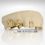 Custom Grillz 4pc: Gap Filler with 3D Star - Sterling Silver Option
