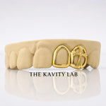 Custom 2pcs Open Face with Cross Grillz: 925 Sterling Silver (Free Mold Kit)