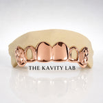 Custom 6pc Open Face x Diamond Cuts on Fangs: 925 Sterling Silver (Free Mold Kit)
