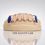 Custom 6pc Open Face with Opals on Fangs Grillz: 925 Sterling Silver (Free Mold Kit)