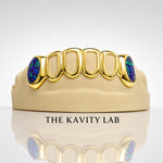 Custom 6pc Open Face with Opals on Fangs Grillz: 925 Sterling Silver (Free Mold Kit)