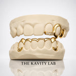 Custom 3on6 Moissanite Fang and Front Bar Grillz: 925 Sterling Silver (Free Mold Kit)